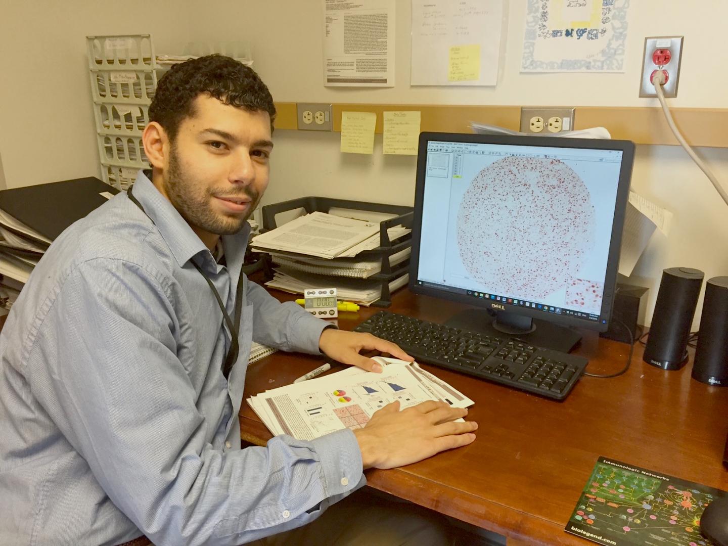 Experimental Drug Could Stop Melanoma, Other Cancers, Research Suggests (3 of 3)