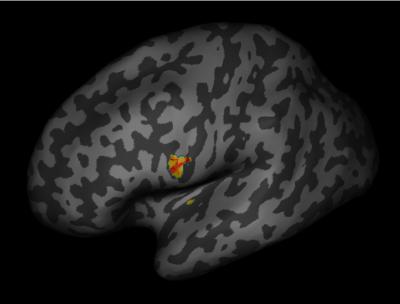 Brain Image Illustrating Paper in <i>Current Biology</i>