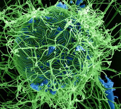 Scanning Electron Micrograph of Filamentous Ebola Virus Particles