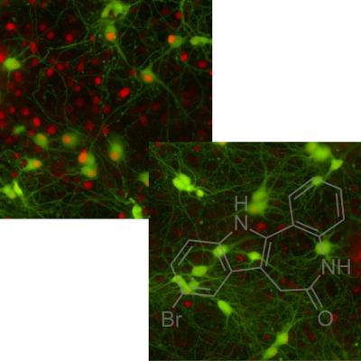New Stem Cell-Based Screen Reveals Promising Drug for Lou Gehrig's Disease