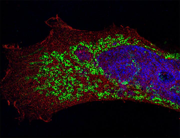 Flu-infected Cell