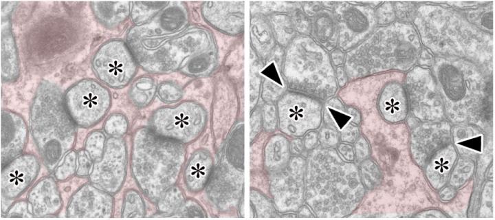 Connections Between Purkinje Cells and Climbing Fibers