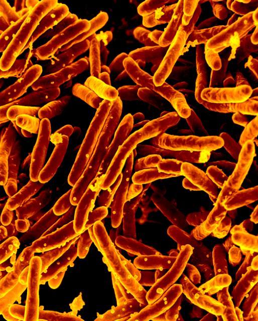 Inching Closer to a Soft Spot in Antibiotic-Resistant Tuberculosis