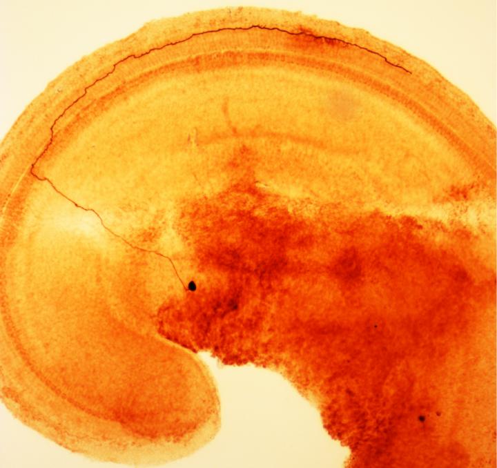 Inner Ear Nerve Cells Warn Brain of Damage