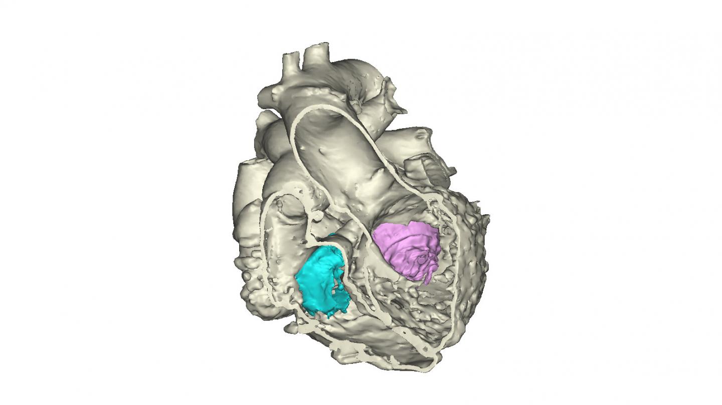 Heart Model