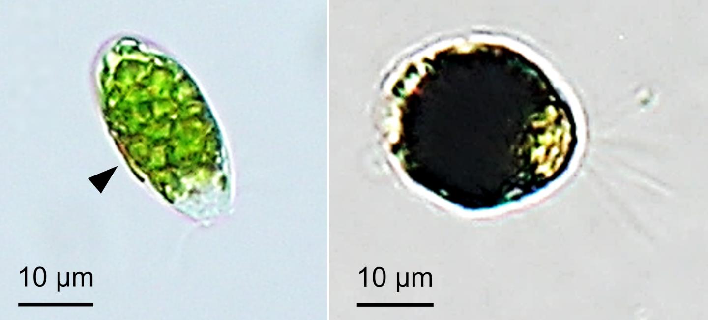 Living and fixed zoospores of A. linnaei