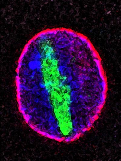 The Breakdown of Barriers in Old Cells May Hold Clues to Aging Process