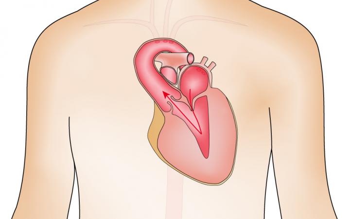 Aortic Valve