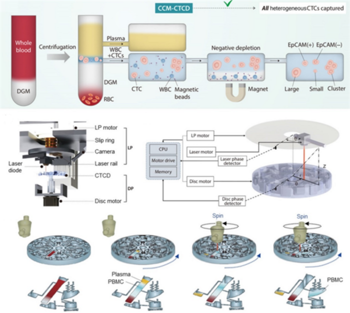 Circulating tumor cells(CTC) separation using Continuous Centrifugal Microfluidics(CCM) technology