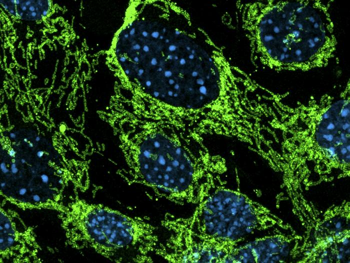 Healthy cells with elongated mitochondria network