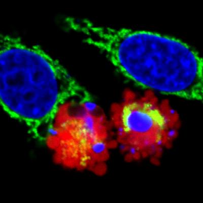 Parkin-Induced Cell Death (1 of 2)