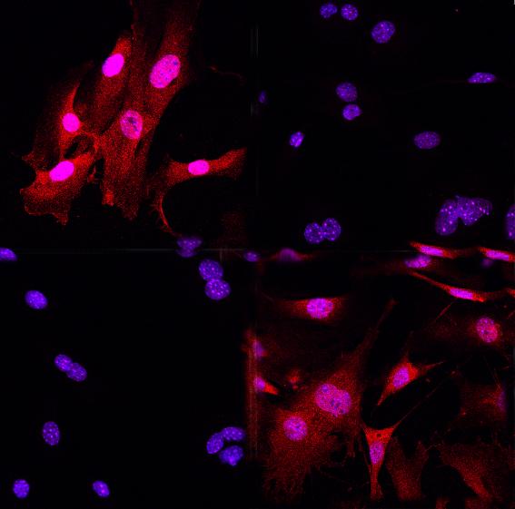 Immunfluoreszenz-FÃ¤rbung vom GR (Glucocorticoid-Rezeptor, rot) in Maus-Zellen