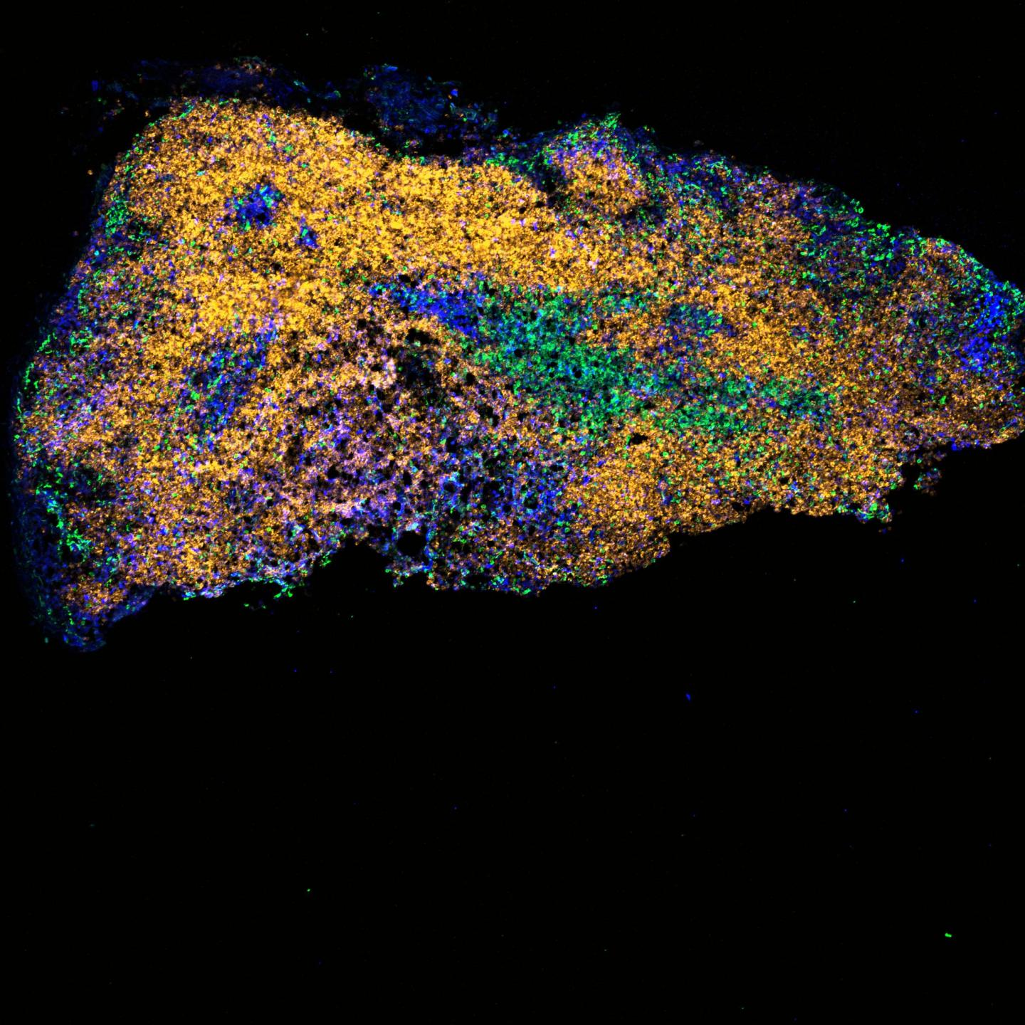 Lymph Node from An Aged Mouse Post Vaccination