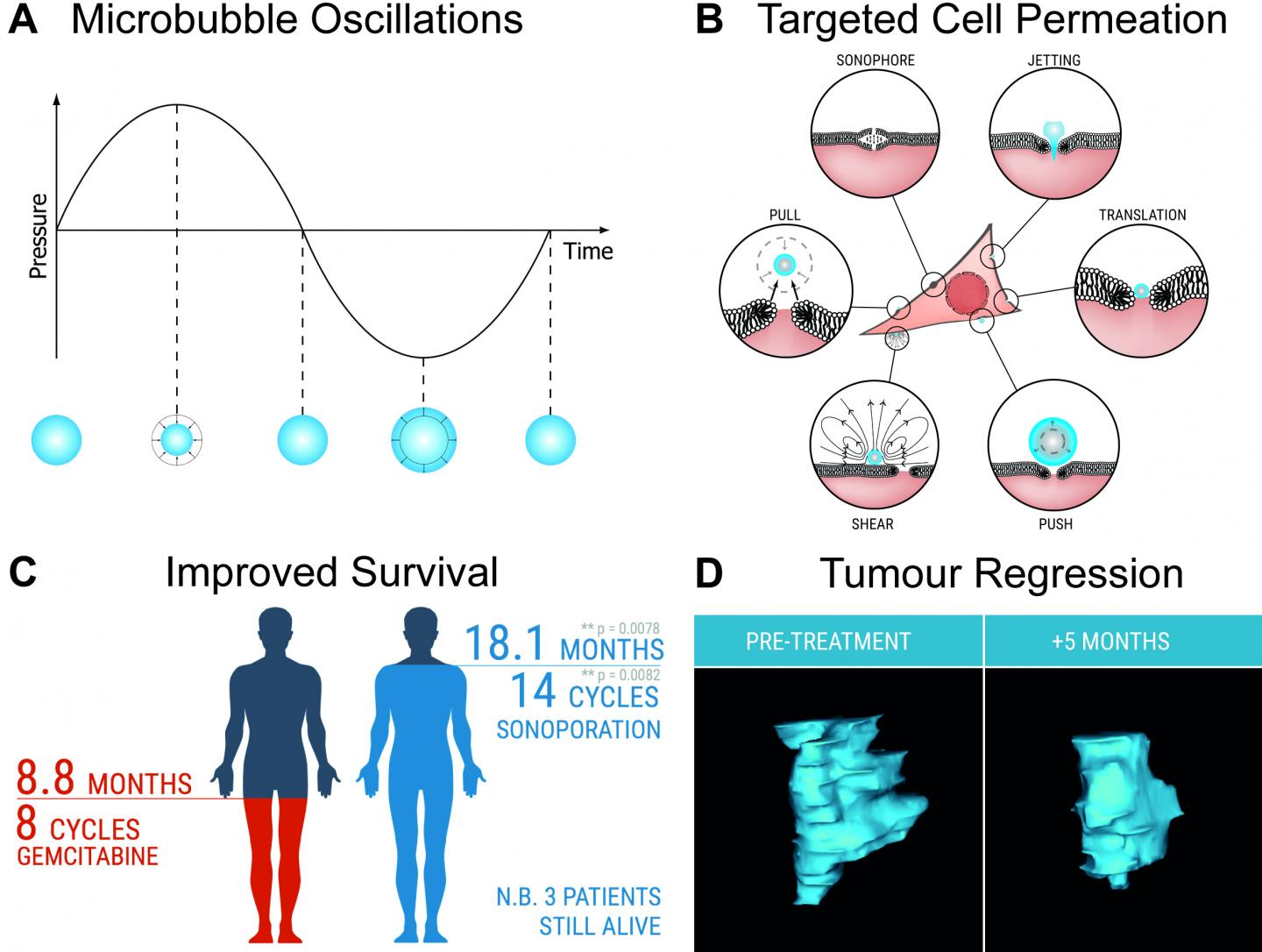 Mechanisms and Benefits of Sonoporation