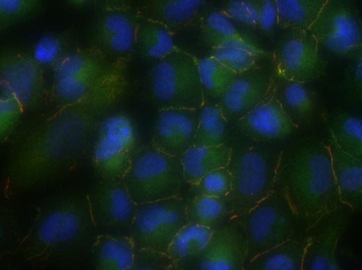 Cell Junctions