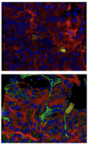 Tissue-embedded nanoelectronics