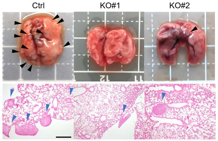 PDPN lung metastasis