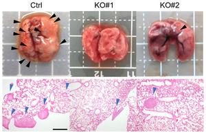 PDPN lung metastasis