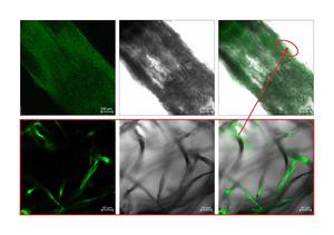 Fungal filaments