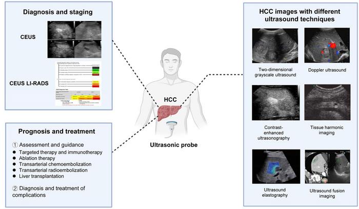 Ultrasonography of Hepatocellular Carcinoma: From Diagnosis to Prognosis