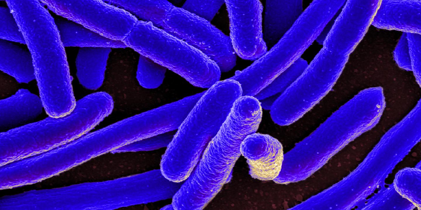 <I>E. coli</I> SEM