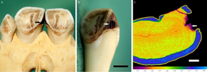 Dental decay on the upper right central incisor in a Dent’s mona monkey
