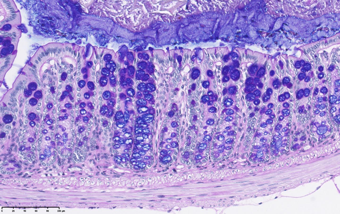 Colon Cells with Deleted KChlP3