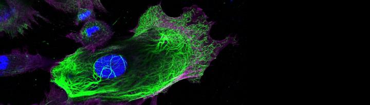 Image Two - Breast Cancer Cells