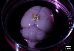 Nanowires on rat brain
