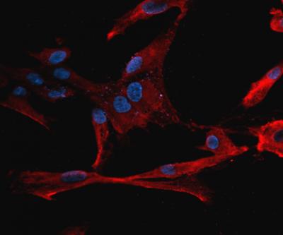 Lung Taste Receptors