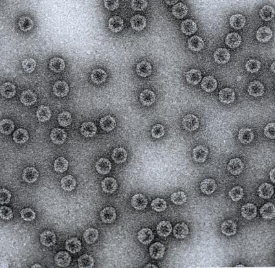 Scanning Electron Micrograph of Cytos' Virus-Like Particle