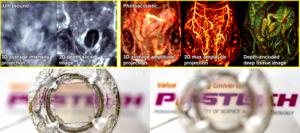 Ultrasound-photoacoustic dual modal imaging of TUT and mouse abdomen