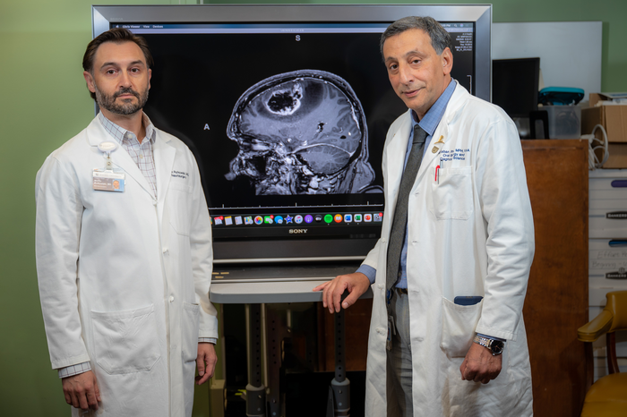 CBD reduces glioblastoma’s size, supportive environment in experimental model