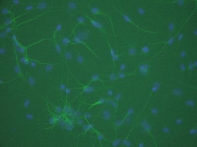 Immunohistochemical Staining