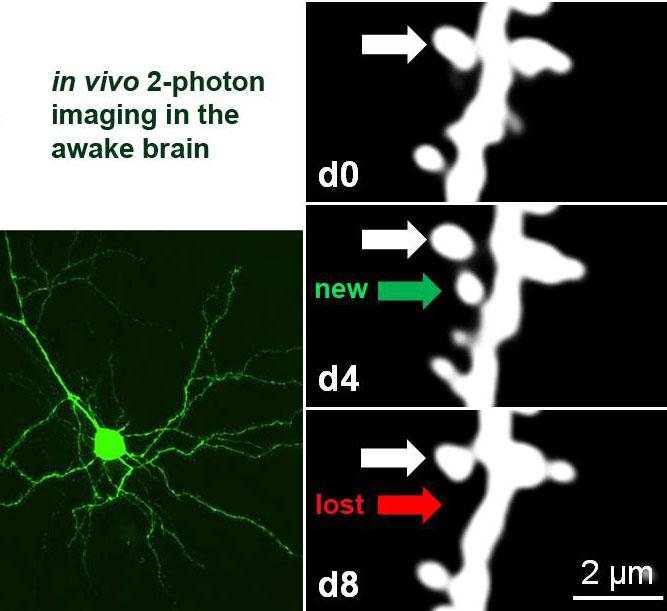 Neuron and imaging