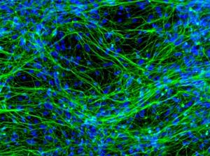 Study reveals specific neuronal circuits and therapeutic mechanisms of delta opioid receptors in anxiety-like behavior