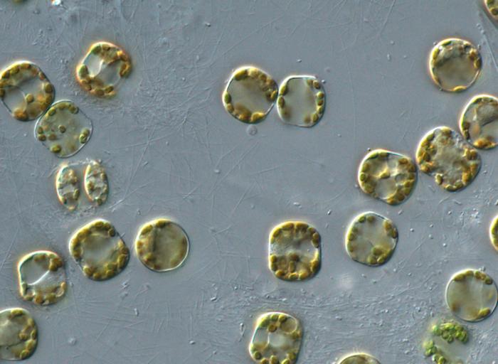 FKt240412-20240424-PeterVonDassowMicroscopeImagery-diatoms_that_sunk_to_50m