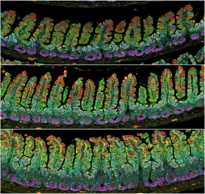 Gut epithelium