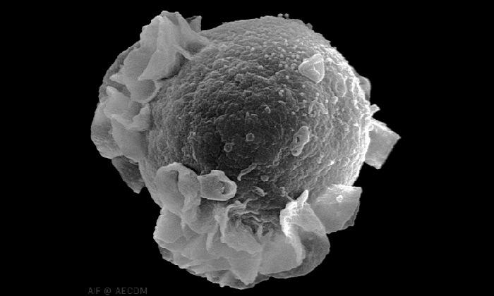Epstein-Barr Virus Erupts from Infected Immune Cell