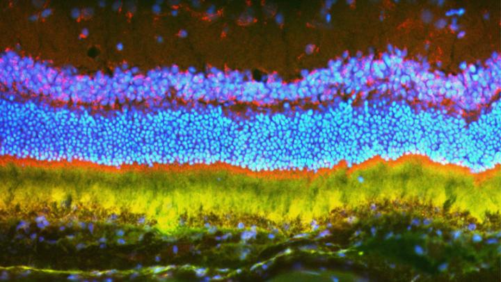 Nanopracticle Gene Therapy