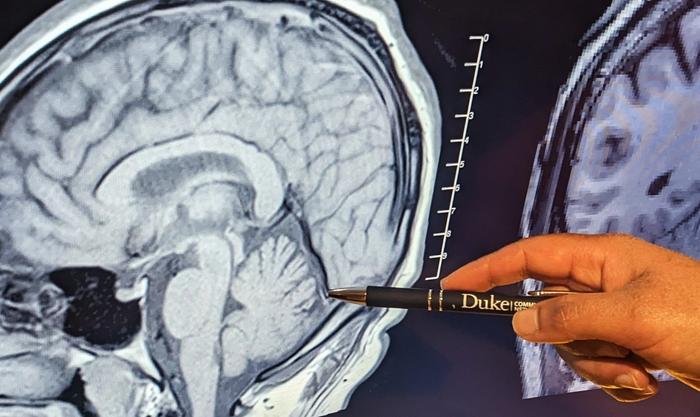 Cerebellum in a Human Brain