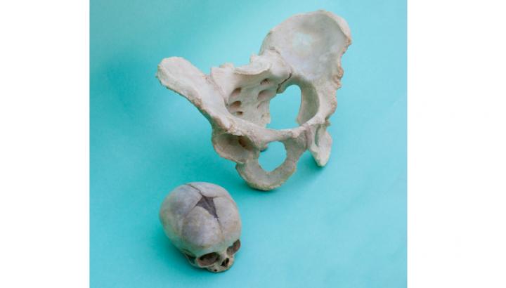 Photo of a female human pelvis and skull of a newborn baby. (© Barbara Fischer)