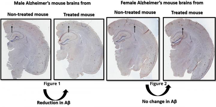 Comparison of Male, Female Treated Brains