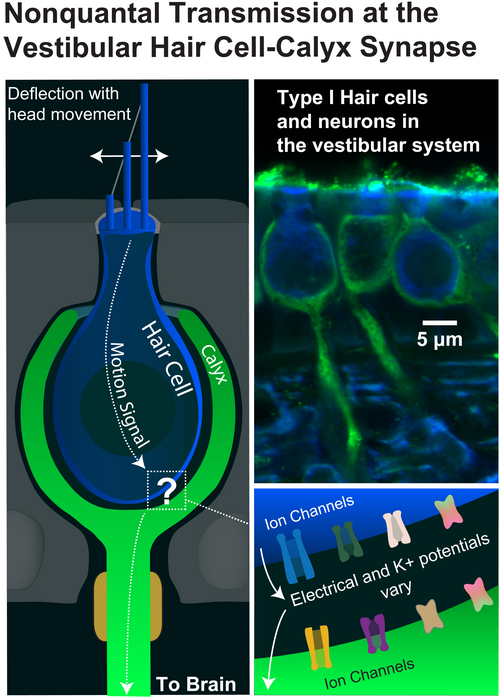 Vestibular hair cell-calyx illustration and microscopic image