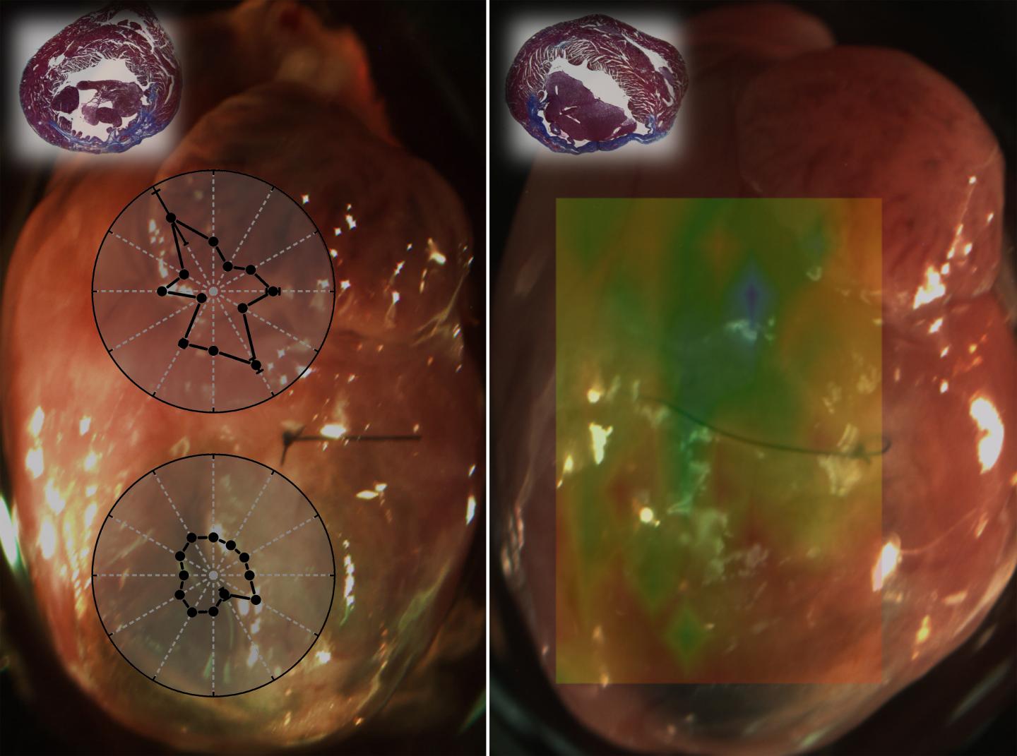 OCE Assessment of Heart Attack Damage