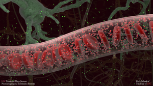 Blood vessels in the brain