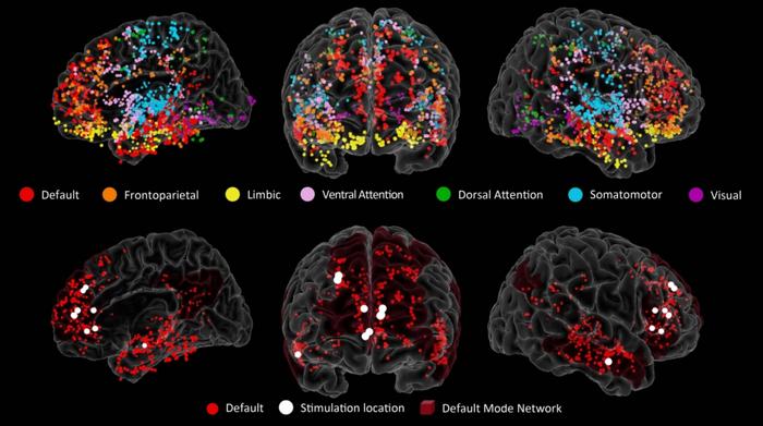 Brain electrode map