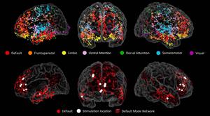 Brain electrode map