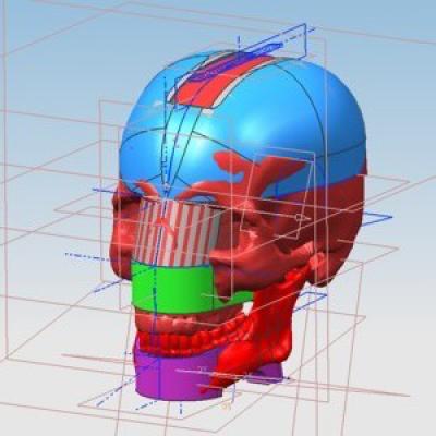 Chewing Robot (1 of 3)