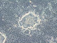 Colony of iPS Cells (3 of 3)